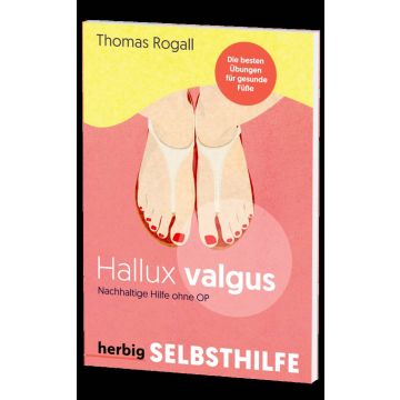 Hallux valgus